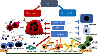 The Impact of High Dose Glucocorticoids on Bone Health and Fracture Risk in Systemic Vasculitides